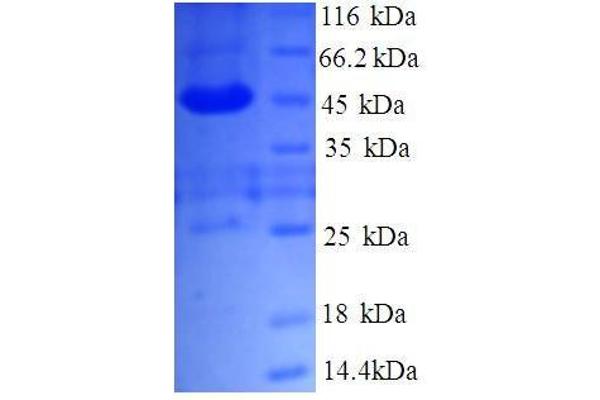 TMED9 Protein (AA 40-197, partial) (GST tag)