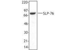 Image no. 1 for anti-Lymphocyte Cytosolic Protein 2 (SH2 Domain Containing Leukocyte Protein of 76kDa) (LCP2) (AA 216-434) antibody (ABIN230462) (LCP2 antibody  (AA 216-434))