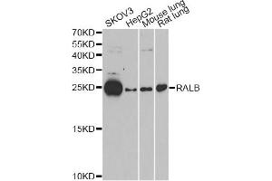 Western blot analysis of extracts of various cell lines, using RALB antibody (ABIN6293713) at 1:1000 dilution. (RALB antibody)