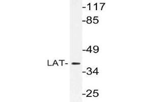 Western blot (WB) analysis of LAT antibody in extracts from Jurkat cells. (LAT antibody)