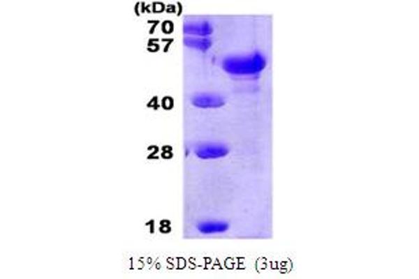 PTX3 Protein (AA 18-381) (His tag)