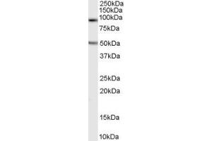 Western Blotting (WB) image for anti-Chromosome 16 Open Reading Frame 90 (C16ORF90) (N-Term) antibody (ABIN2156472) (C16ORF90 antibody  (N-Term))