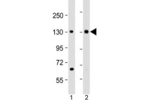 Western blot testing of human 1) HeLa and 2) Jurkat cell lysate with MTUS1 antibody at 1:2000. (MTUS1 antibody  (AA 983-1017))