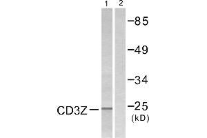 Western blot analysis of extracts from Jurkat cells, treated with UV (15mins), using CD3 ζ (Ab-42) antibody. (CD247 antibody  (Tyr42))