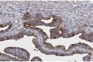 ABIN6267299 at 1/200 staining human Fallopian tube sections by IHC-P. (Integrin beta 3 antibody  (pTyr773))