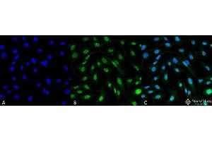Immunocytochemistry/Immunofluorescence analysis using Mouse Anti-MDC1 Monoclonal Antibody, Clone P2B11 . (MDC1 antibody  (N-Term) (PE))