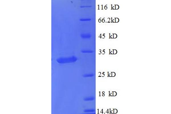 MT1X Protein (AA 1-59, partial) (GST tag)