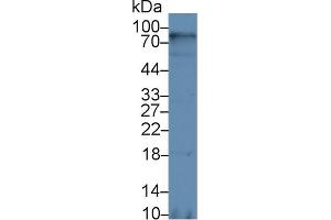 Western Blot; Sample: Human Hela cell lysate; Primary Ab: 5µg/ml Rabbit Anti-Rat cADPRH Antibody Second Ab: 0. (CD38 antibody  (AA 53-284))