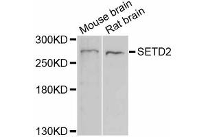 Western blot analysis of extracts of various cell lines, using SETD2 antibody (ABIN6290482) at 1:1000 dilution. (SETD2 antibody)