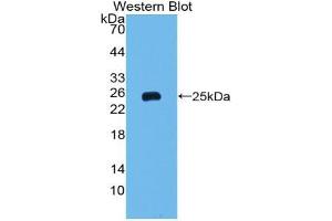 Western blot analysis of the recombinant protein. (FTH1 antibody  (AA 1-183))