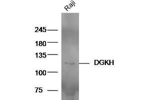 Raji cell lysates probed with Anti-DGKH Polyclonal Antibody  at 1:5000 90min in 37˚C. (DGKH antibody  (AA 51-150))