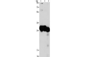Western Blotting (WB) image for anti-Ketohexokinase (KHK) antibody (ABIN2429499) (Ketohexokinase antibody)