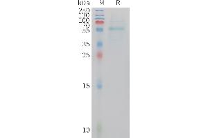 Human ADIPOQ Protein, hFc Tag on SDS-PAGE under reducing condition. (ADIPOQ Protein (AA 19-244) (Fc Tag))