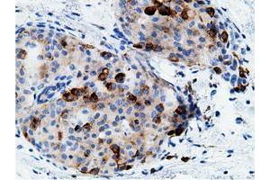 Image no. 2 for anti-CD80 (CD80) antibody (ABIN1497365) (CD80 antibody)