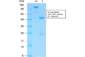 SDS-PAGE (SDS) image for anti-Glial Fibrillary Acidic Protein (GFAP) antibody (ABIN6939509)