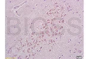 Formalin-fixed and paraffin embedded rat brain tissue labeled with Anti-Integrin beta 1/CD29 Polyclonal Antibody (ABIN669216), Unconjugated at 1:200, followed by conjugation to the secondary antibody and DAB staining (ITGB1 antibody  (AA 25-100))