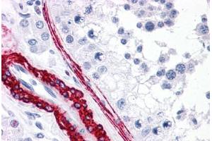 Human Testis: Formalin-Fixed, Paraffin-Embedded (FFPE) (CARD10 antibody  (N-Term))