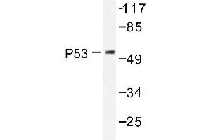 Image no. 1 for anti-Tumor Protein P53 (TP53) antibody (ABIN272050) (p53 antibody)