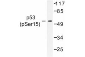 Image no. 1 for anti-Tumor Protein P53 (TP53) (pSer15) antibody (ABIN318091) (p53 antibody  (pSer15))