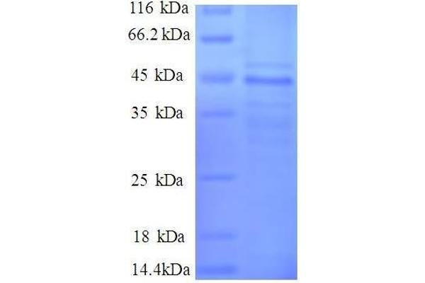 MYL6 Protein (AA 3-151, partial) (GST tag)