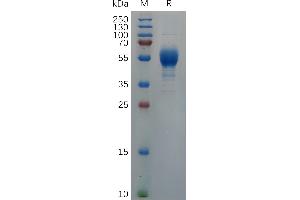 Cynomolgus IL9 Protein, hFc Tag on SDS-PAGE under reducing condition. (IL-9 Protein (AA 19-144) (Fc Tag))