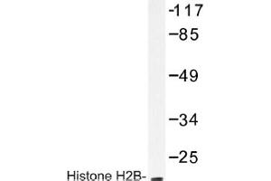 Image no. 1 for anti-Histone H2B antibody (ABIN317616) (Histone H2B antibody)