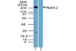 Image no. 1 for anti-Notch 2 (NOTCH2) (AA 1550-1600) antibody (ABIN960288) (NOTCH2 antibody  (AA 1550-1600))