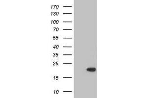 Western Blotting (WB) image for anti-Crystallin, alpha B (CRYAB) antibody (ABIN1497650) (CRYAB antibody)