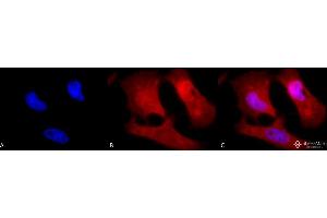 Immunofluorescence (fixed cells) (IF/ICC) image for anti-Phosphotyrosine antibody (ABIN361758)