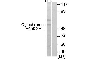 Western blot analysis of extracts from HT-29 cells, using Cytochrome P450 2B6 antibody. (CYP2B6 antibody)