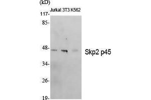 Western Blotting (WB) image for anti-S-Phase Kinase-Associated Protein 2 (SKP2) (C-Term) antibody (ABIN3180876) (SKP2 antibody  (C-Term))