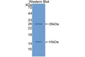 Western Blotting (WB) image for anti-Antigen Identified By Monoclonal Antibody Ki-67 (MKI67) (AA 2815-2928) antibody (ABIN1078250) (Ki-67 antibody  (AA 2815-2928))