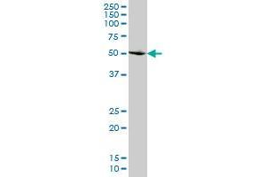 SMAD2 monoclonal antibody (M07), clone 2D7 Western Blot analysis of SMAD2 expression in HeLa . (SMAD2 antibody  (AA 181-280))