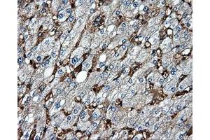 Immunohistochemical staining of paraffin-embedded liver tissue using anti-MTRF1L mouse monoclonal antibody. (MTRF1L antibody)