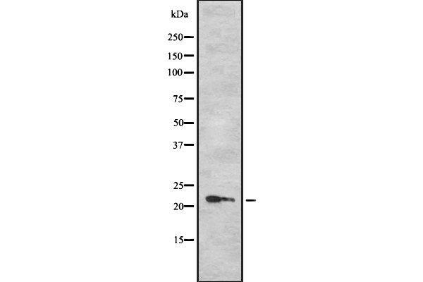 TPD52L1 antibody  (N-Term)