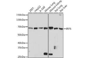 Western blot analysis of extracts of various cell lines, using IRF6 Rabbit mAb (ABIN1680921, ABIN3017588, ABIN3017589 and ABIN7101507) at 1:1000 dilution. (IRF6 antibody)