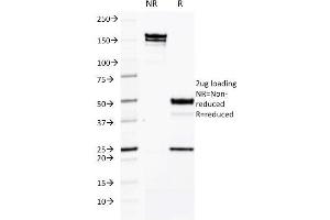 SDS-PAGE Analysis Purified CD50 Mouse Monoclonal Antibody (CG106). (ICAM-3/CD50 antibody)