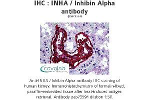 Image no. 1 for anti-Inhibin, alpha (INHA) antibody (ABIN5693611) (Inhibin alpha antibody)