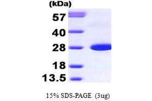 CALB1 Protein (AA 1-261)