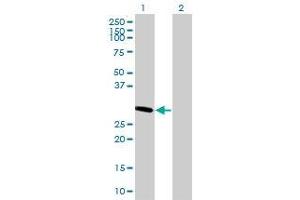 Western Blotting (WB) image for FCN3 293T Cell Transient Overexpression Lysate(Denatured) (ABIN1334137)