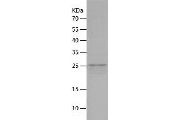 Beclin 1 Protein (AA 1-450) (His tag)