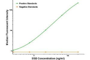 Luminex Assay (LMNX) image for anti-Sjogren Syndrome Antigen B (SSB) antibody (ABIN2732683) (SSB antibody)