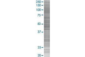 GMCL1L transfected lysate. (GMCL1L 293T Cell Transient Overexpression Lysate(Denatured))