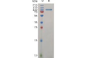 Human L  Protein, His Tag on SDS-PAGE under reducing condition. (Lrig1 Protein (AA 35-792) (His tag))