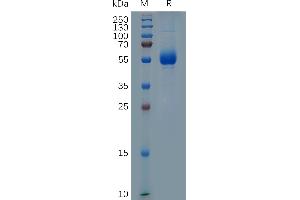 Human CD33, hFc Tag on SDS-PAGE under reducing condition. (CD33 Protein (CD33) (AA 140-259) (Fc Tag))