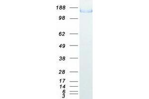 Validation with Western Blot (L1CAM Protein (Transcript Variant 1) (Myc-DYKDDDDK Tag))