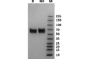 Human Fc gamma RI / CD64 protein on Coomassie Blue stained SDS-PAGE under non-reducing (NR) and reducing (R) conditions. (FCGR1A Protein (AA 16-281) (His-Avi Tag,Biotin))
