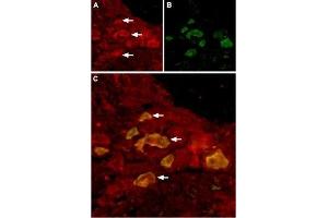 Expression of TRPV6 in rat DRG - Immunohistochemical staining of rat dorsal root ganglion (DRG) using Anti-TRPV6 Antibody (ABIN7043857, ABIN7043998 and ABIN7043999), (1:100). (TRPV6 antibody  (C-Term, Intracellular))