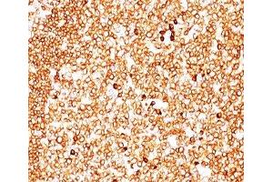 IHC testing of human tonsil (10X) stained with CD79a antibody cocktail (JCB117 + HM47/A9). (CD79a antibody  (AA 202-216))