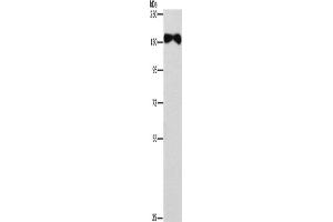 Western Blotting (WB) image for anti-Ellis Van Creveld Syndrome 2 (EVC2) antibody (ABIN2433003) (EVC2 antibody)